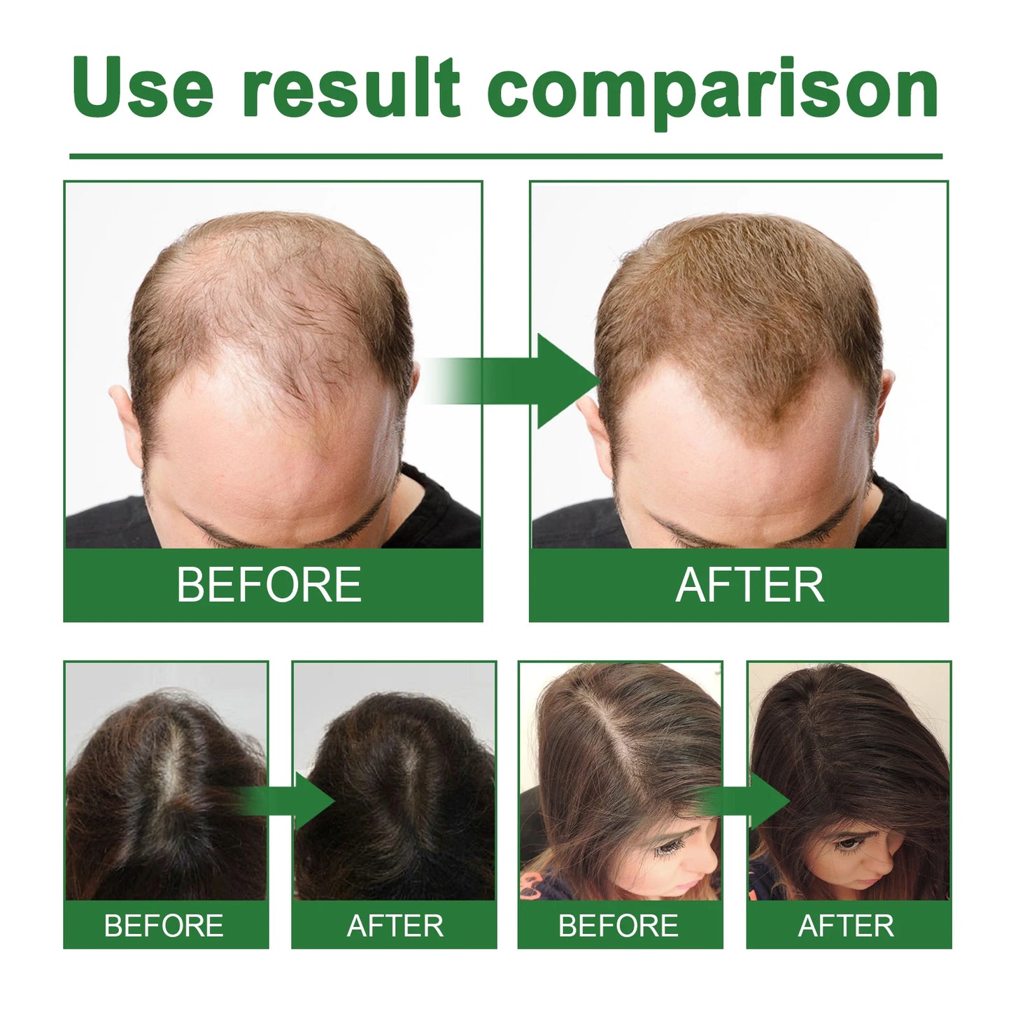 EELHOE 30ml Rosemary Hair Growth Essential Oil Pure Natural Nourishing Repair Hair Damage Strengthening Hair Root Long-term Care
