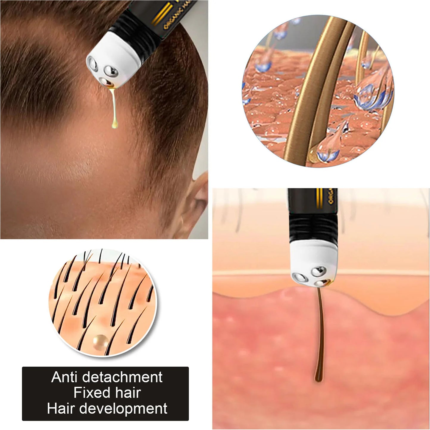 EELHOE Regrowth Hair Serum With Roller Massage Scalp Pure Natural Nourishing Roots Prevent Hair Loss Damage Thickness Hairs Care