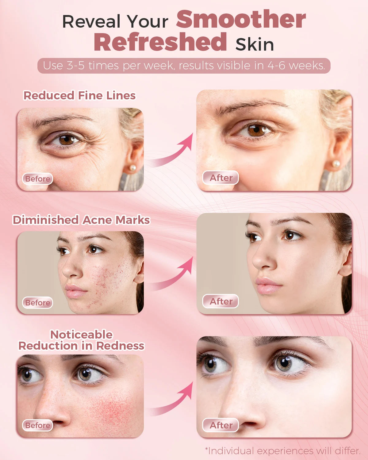LED Light Therapy Mask For Professional Skin Rejuvenation Treatment