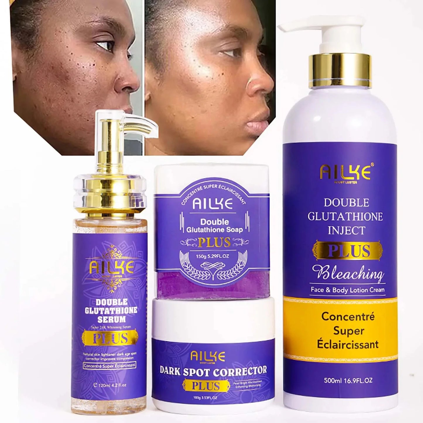 AILKE Whitening Lotion and Serum, Reduce Black Spots, Sun Spots, Melasma, Hyperpigmentation, Lighten Skin With Glutathione