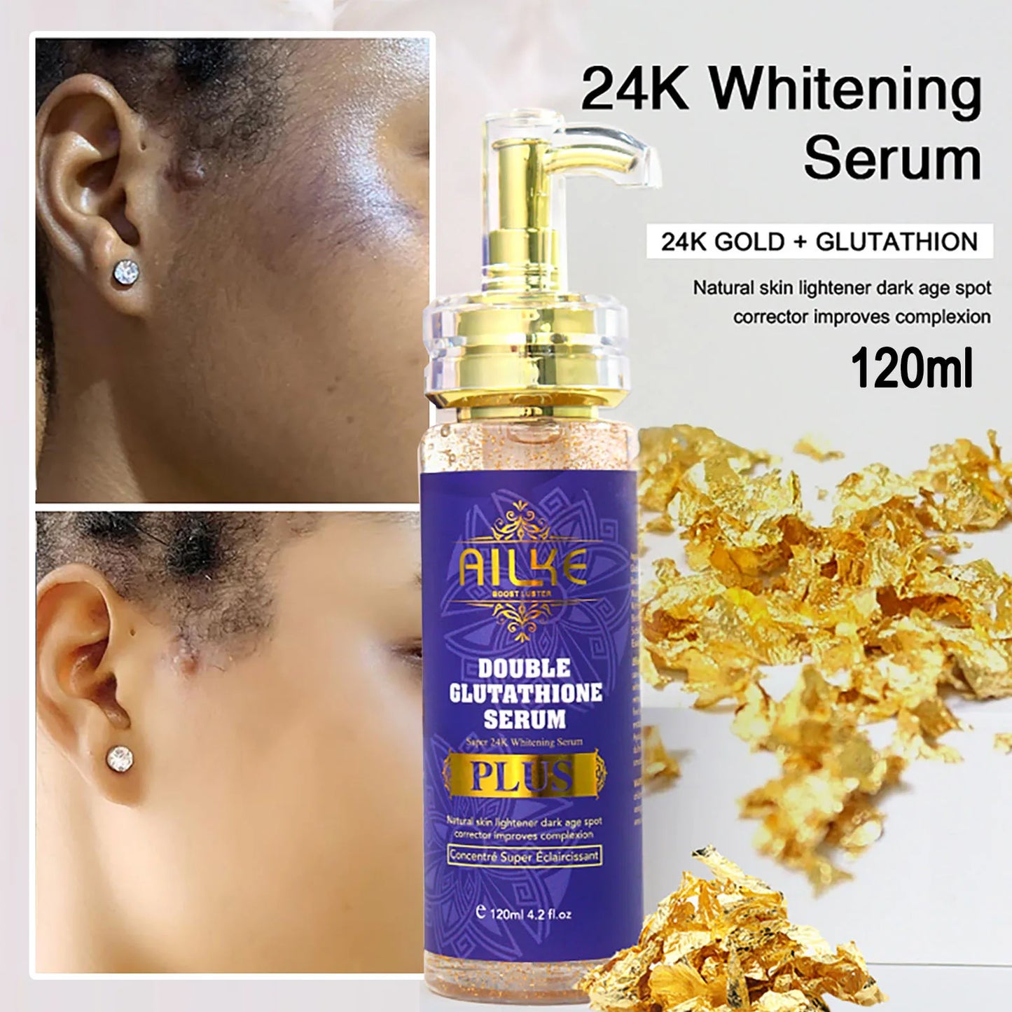 AILKE Whitening Lotion and Serum, Reduce Black Spots, Sun Spots, Melasma, Hyperpigmentation, Lighten Skin With Glutathione
