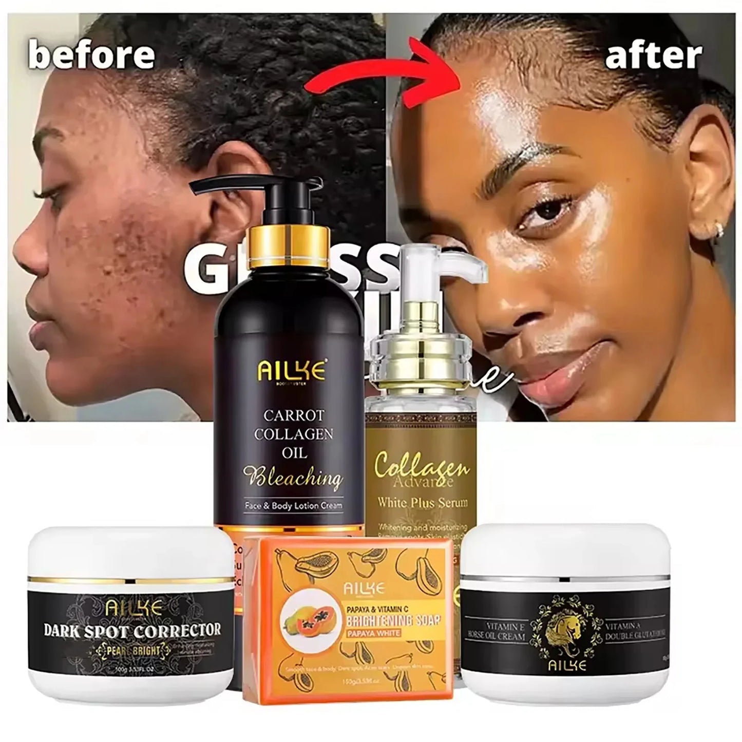 AILKE Collagen Beauty Skin Care, Anti Spots, Pigmentation, Lightening, Even Skin Tone, For Dark, Black, African and Caramel Skin